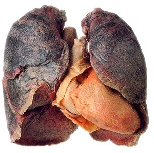healthy-lung-and-smokers-lungff