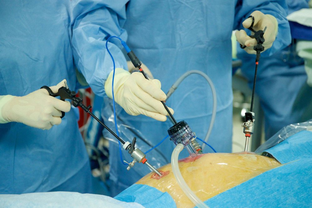 Best General & Laparoscopy Surgery in Indore